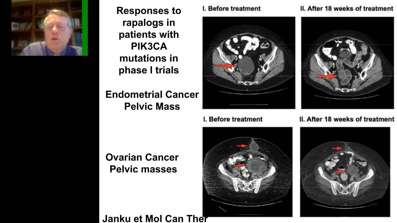 Gordon Mills - Keynote - Delivering on the promise of personalized medicine