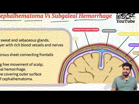 Caput Succedaneum Vs Cephalhematoma - Scalp Swellings in the Newborn