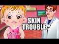 Baby Hazel Skin Trouble Fun Game Videos By Baby Hazel Games