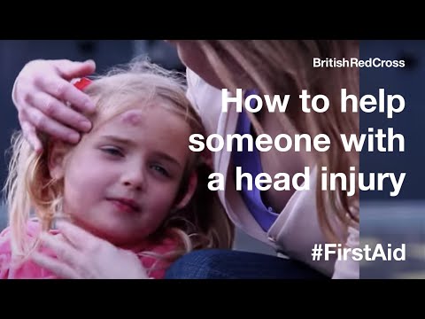 How to help someone who has a head injury 