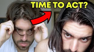Is my hair still thinning? | My hair loss strategy (manual)