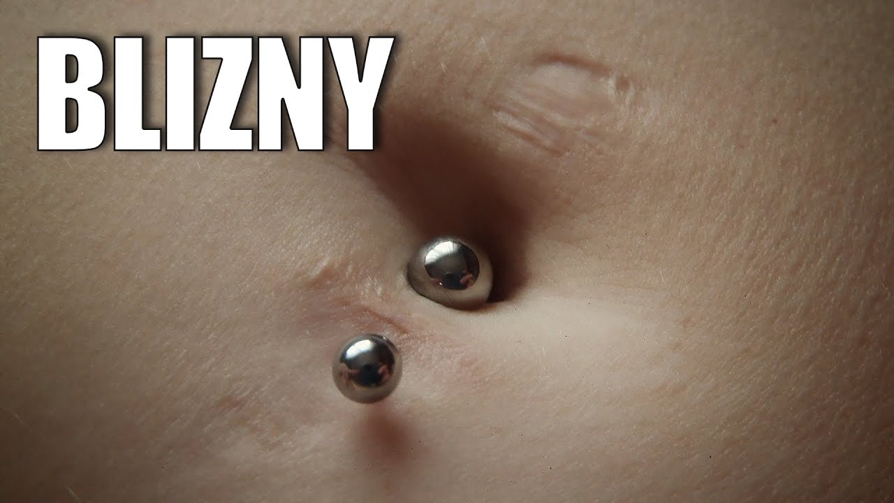 BLIZNY po przekłuciach - jak się ich pozbyć ✪ Bezpieczny piercing ✪