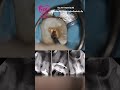 Download Lagu case 33: perawatan akar gigi atau perawatan saluran akar root canal treatment by drg. m. furqan SpKG Mp3 Free