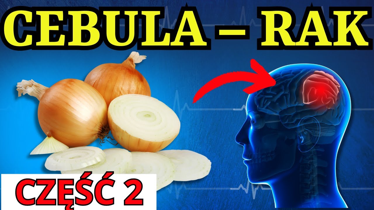 🧅 NIGDY nie jedz CEBULI z TYMI produktami… Ryzyko RAKA i DEMENCJI. 🧅 3 NAJGORSZE kombinacje. CZĘŚĆ 2