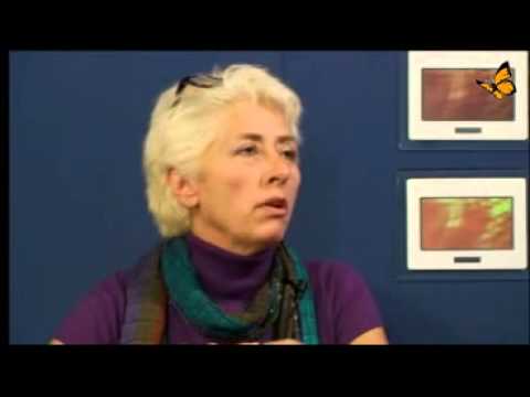 MRI des Knies Transkript Wo menschliche Gelenke