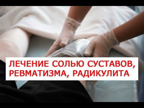 Moller nivelille omega 3 комплекс для суставов 76 капсул отзывы Упражнение при остеохондрозе и грыжах