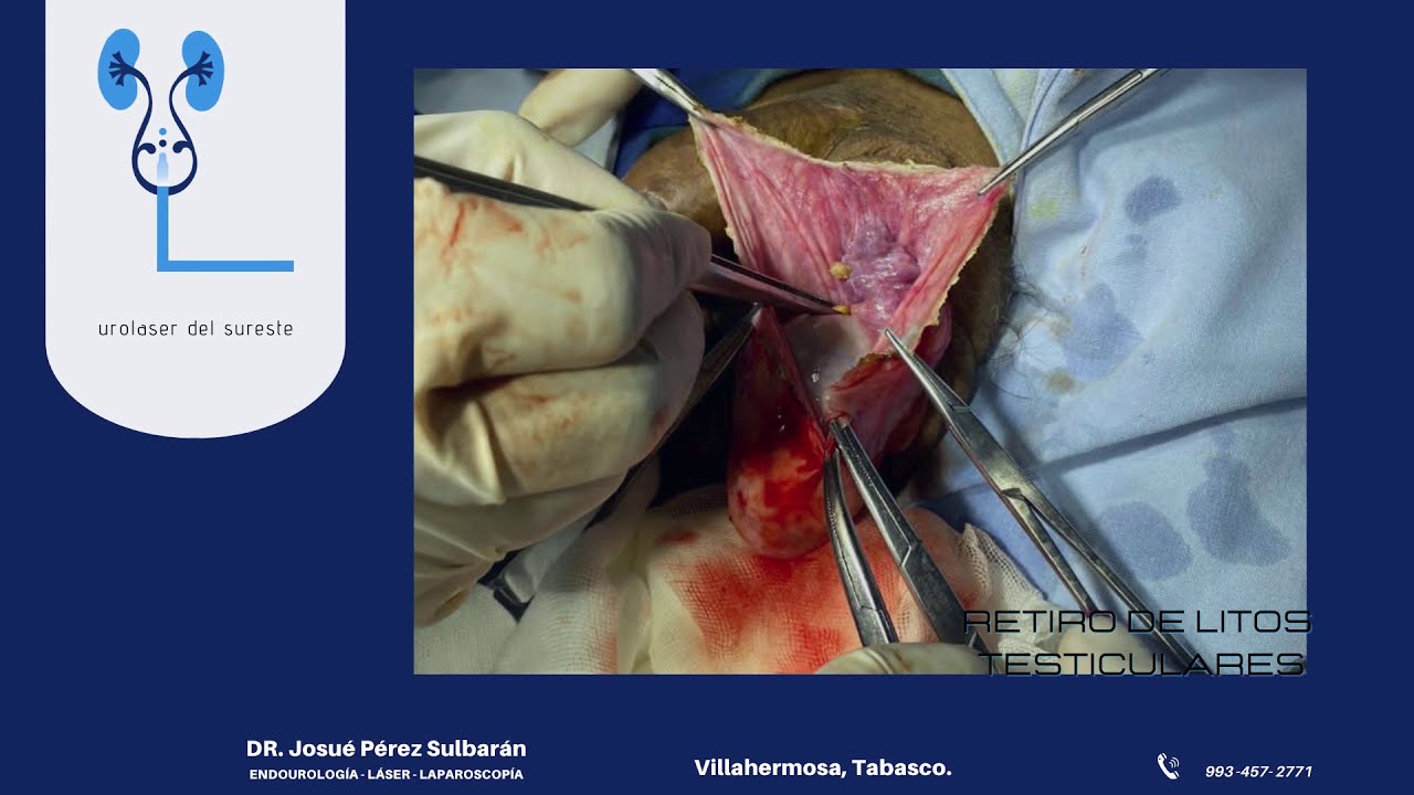 Josué Pérez Sulbarán-10