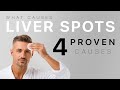 What Causes Liver Spots? 4 Proven Causes