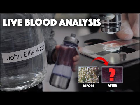 15 Mins Before and After Drinking John Ellis Water | Live Blood Analysis