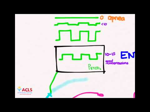 PALS Monitoring and Vascular Access  by ACLS Certification Institute