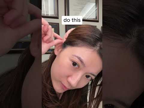 Treat your eye stye naturally with acupressure