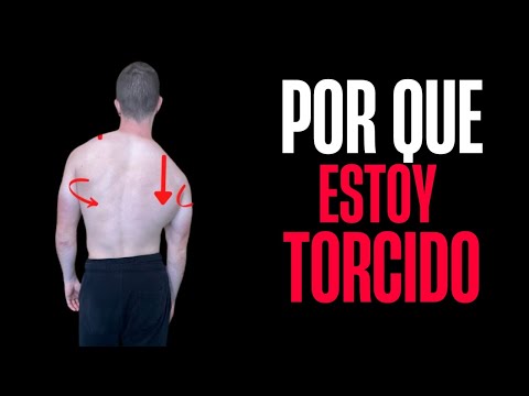 Corrige tu postura asimétrica | Asimetría postural | Corregir postura | Ejercicios para la espalda