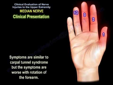 Median nerve injury, causes, symptoms, diagnosis and treatment. Carpal tunnel syndrome diagnosis.
