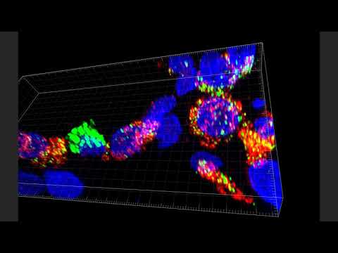 8 Year-Old Human Lung Donor D036 8 Year-Old Human Lung Donor D036