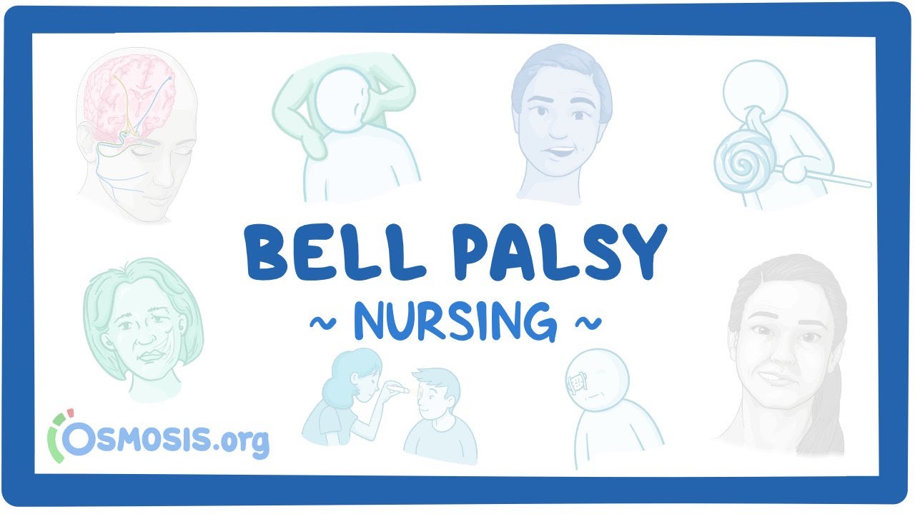 Bell Palsy: Clinical Nursing Care