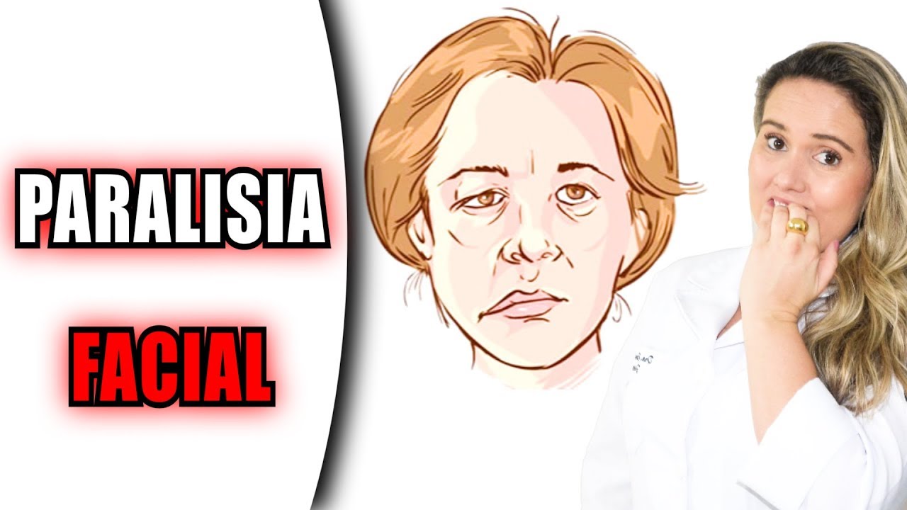 17 Dicas de Exercícios para Paralisia Facial