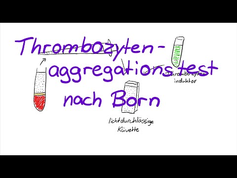 Thrombozytenaggregationstest nach Born