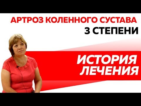 История лечения артроза коленного сустава 3 степени.