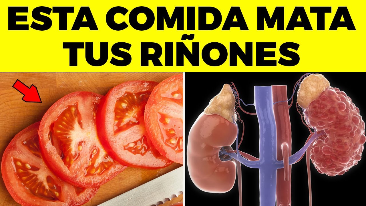 ¡ALERTA! Este alimento es el que MÁS TE DAÑA EL RIÑÓN y nadie te avisa