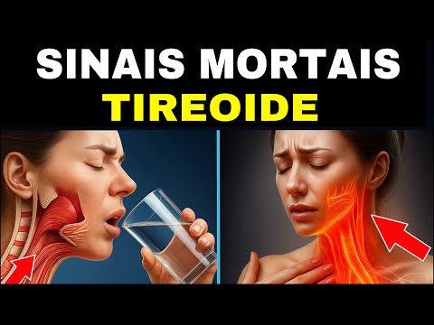 8 SINAIS MORTAIS DA TIREOIDE (NUNCA IGNORE)