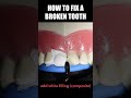 Tooth Filling Shorts