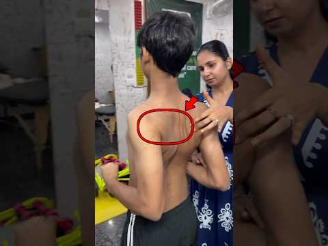 क्या आपके shoulder भी 😭aage झुके हुए है ? To yeh video आपके लिए है 🥵#millionsubscribers #neckpain