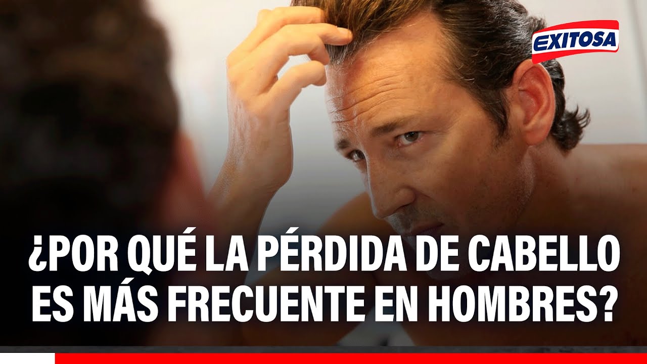 🔴🔵 ¿Por qué la pérdida de cabello es más frecuente en hombres?