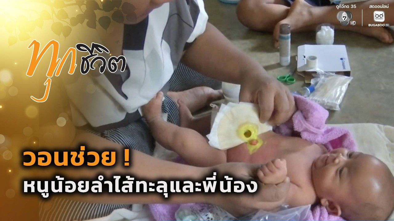วอนช่วย ! หนูน้อยลำไส้ทะลุและพี่น้อง | ทุกชีวิต