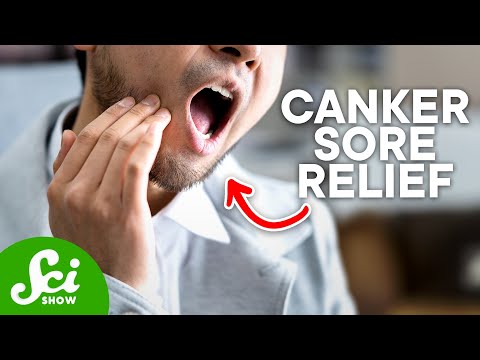 YouTube video about: Can I get my teeth cleaned with a canker sore?