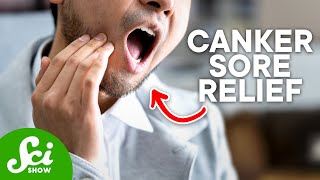 How Do You Get Rid of a Canker Sore?