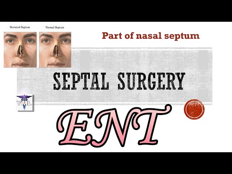 Septal surgery - Part of Nasal septum