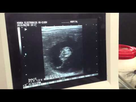 Mierela drachtig Dating AT