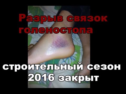 Прибор для лечения суставов в домашних условиях орион Локтевой нерв локтевой сустав