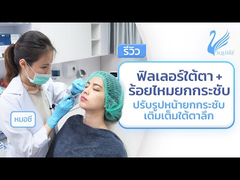เมโสแฟต ยี่ห้อไหนดี