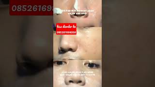 Download lagu cara gunain viva milk cleaner dan viva face tonic mp3 Download lagu cara gunain viva milk cleaner dan viva face tonic mp3