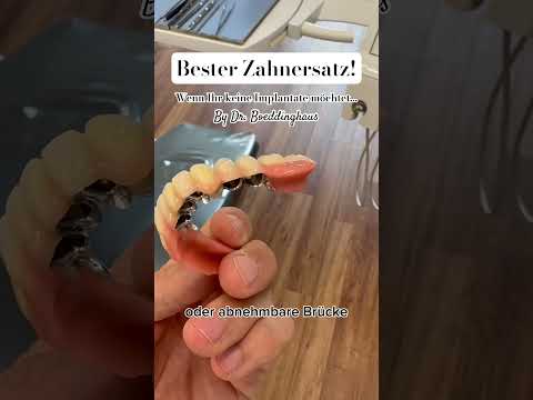 Der BESTE Zahnersatz - Ohne Implantate #zahnersatz #zahnprothese #schönezähne #zahnarzt