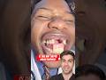 THIS Is How You Lose Your Teeth