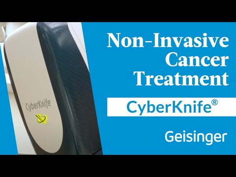 CyberKnife Video 2423