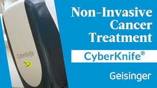 CyberKnife Video 2423