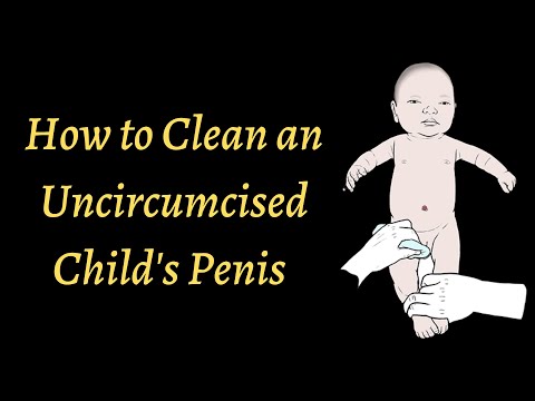 How to Clean an Uncircumcised Child's Penis ▶3:19