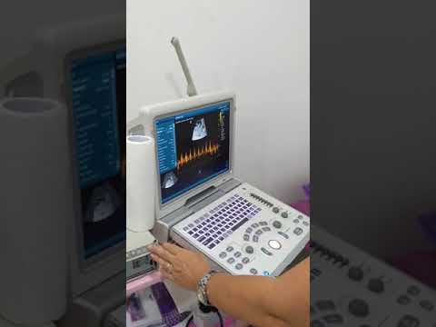 Ecografia de embarazo 10 semanas