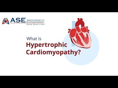 What is HCM and Who is at Risk for HCM?