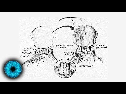 Chiropraktik Rückenschmerzen von degenerativen Bandscheibenerkrankungen Gymnastik für Schmerzen in der Schulter Schultergelenk