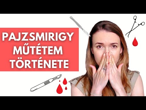 Élelmiszer szóda kezelésére a 2. típusú diabetes mellitus