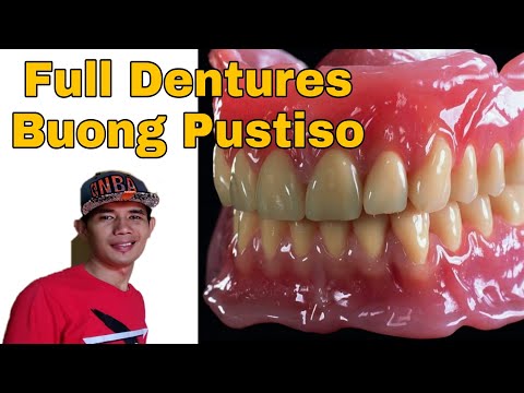 Full Dentures Buong Pustiso Taas at Baba Acrylic Dentures. Dentures in the Philippines.