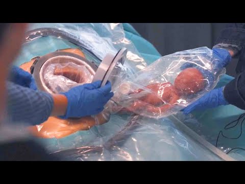 Doctors Create Artificial Womb To Help Premature Babies Grow Stronger