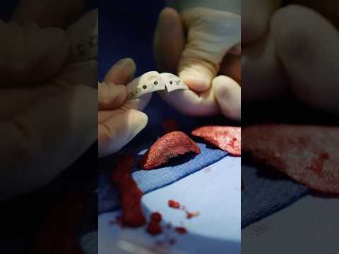 The Future of Plastic Surgery: Custom Jawline Implants — Dr. Jonathan Zelken