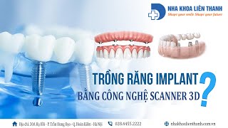 Công nghệ scan lấy dấu răng 3D – Ứng dụng đồng bộ kĩ thuật số trong trồng răng Implant