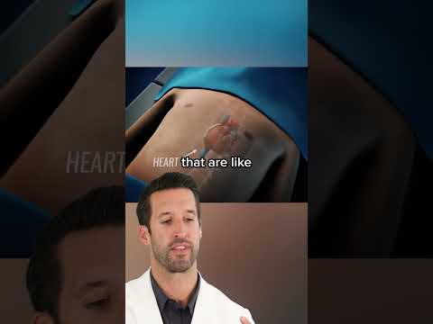 ER Doctor REACTS to Pectus Excavatum