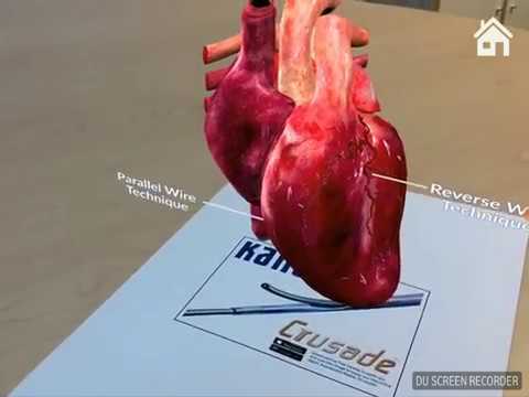 Kaneka Medical Products, Microcatheter Crusade App